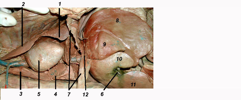 Thoracic Cavity sternum diagram labeled 